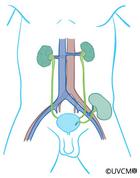 transplantierte Niere links